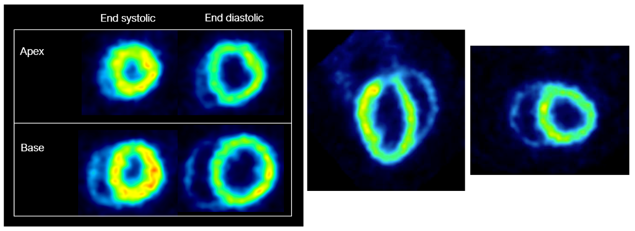 心臟門控.png 心臟門控.png
